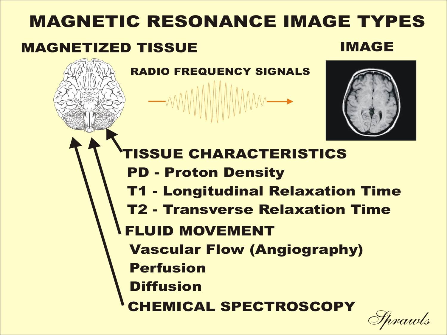 Magnetic Resonance Image Characteristics